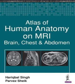 Atlas of Human Anatomy on MRI Brain, Chest and Abdomen Paperback   ( ISBN-13 ‏ : ‎ 978-9386322524)