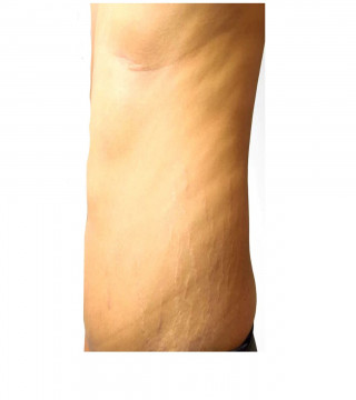 Skin Care›Body›Maternity